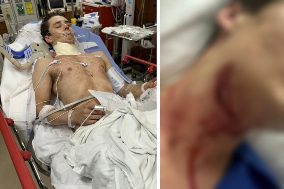 Zachary hat den Rodeo-Unfall überstanden und konnte bereits das Krankenhaus verlassen.