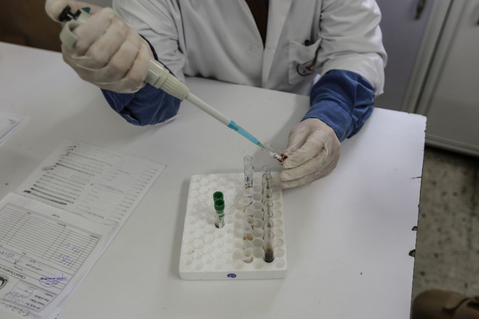 Ein Arzt untersucht eine Blutprobe auf das Coronavirus.