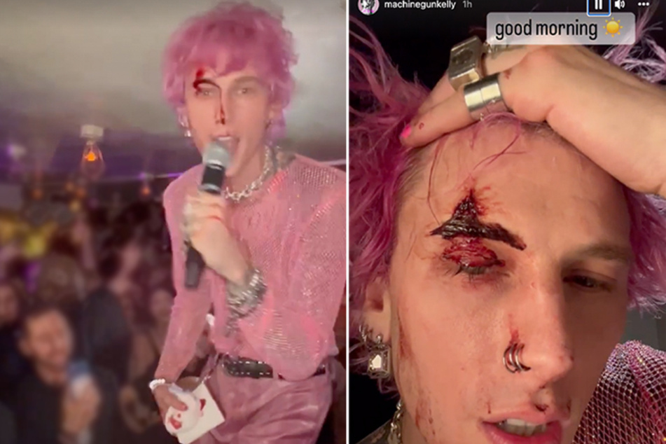 Machine Gun Kelly smashed his face with a glass champagne flute after his sold-out show at Madison Square Garden.