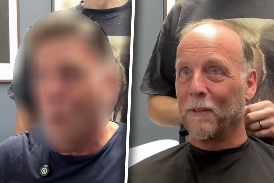 Man krijgt een haarsysteem, daarnaast wordt zijn baard geschoren: Als hij het resultaat ziet, flippt hij uit