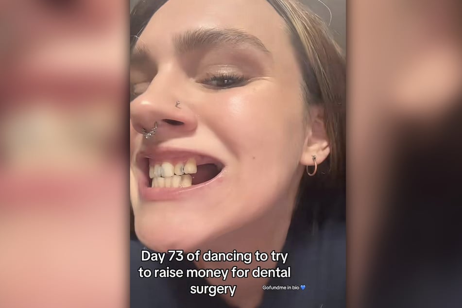 Auf TikTok zeigt Bri Over, wie schlimm es um ihre Zähne steht.
