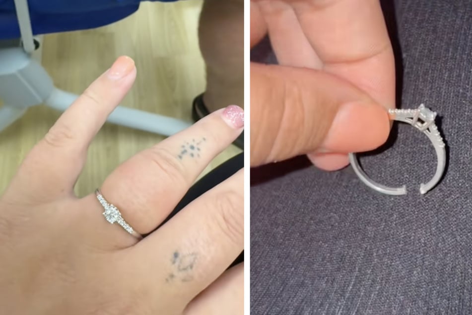 Der Ring musste aufgeschnitten werden, um Ionas Finger zu retten.