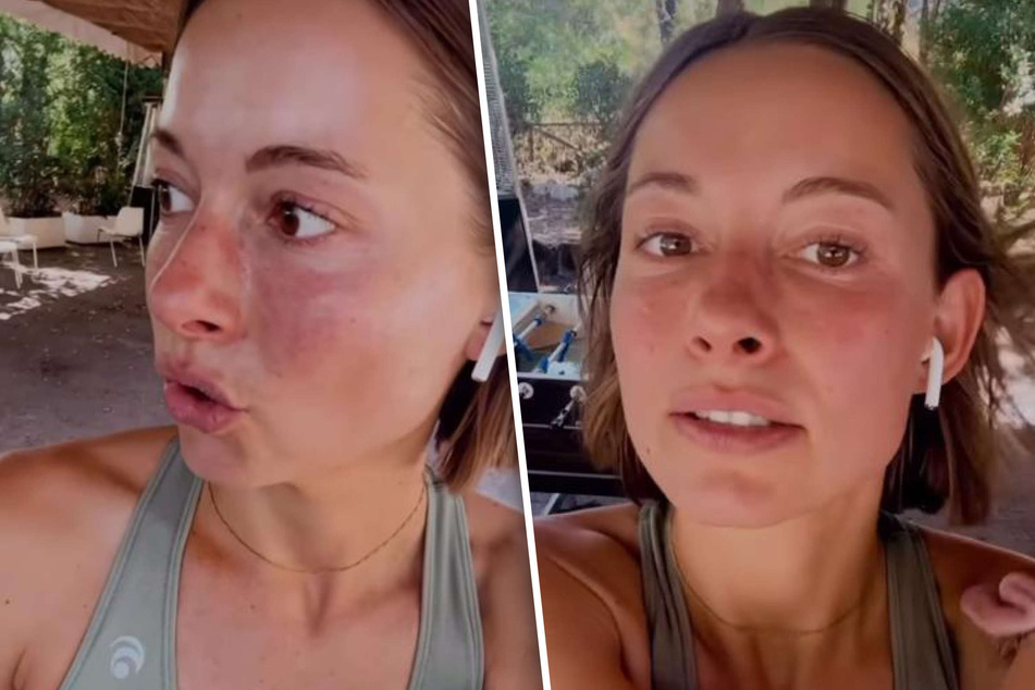 Jennifer Lange (28) wird in Italien von lästigen Mücken geplagt - noch schlimmer erwischt hat es jedoch ihren Freund Darius Zander (38)!