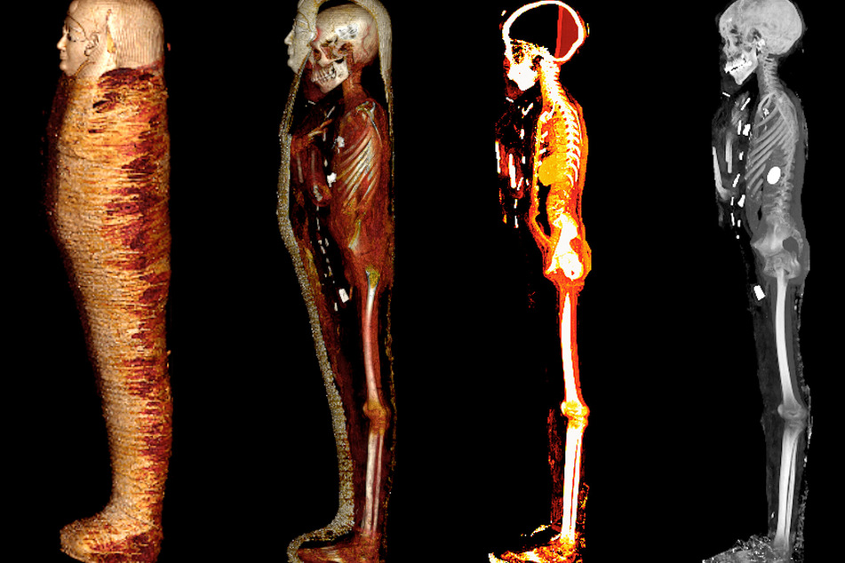 Mithilfe eines CT-Scans haben Wissenschaftler eine 2300 Jahre alte und noch nie geöffnete Mumie durchleuchtet.