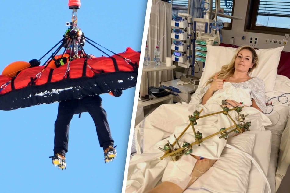 Schon dreimal operiert: Ski-Star Lindsey Vonn teilt erschreckende Fotos aus dem Krankenhaus