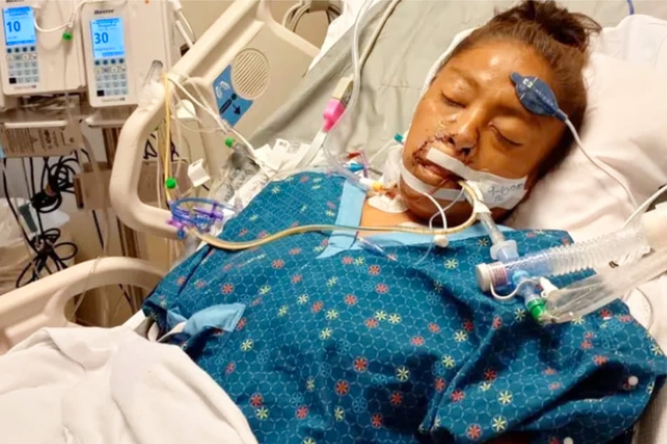 Janelle "Nellie" Scott liegt seit dem 9. September im Krankenhaus und ihre Leidenszeit ist noch nicht vorbei.