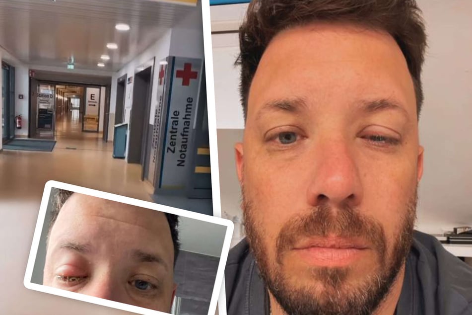 Florian Köster (34) hat zurzeit akute Probleme mit seinem linken Auge.