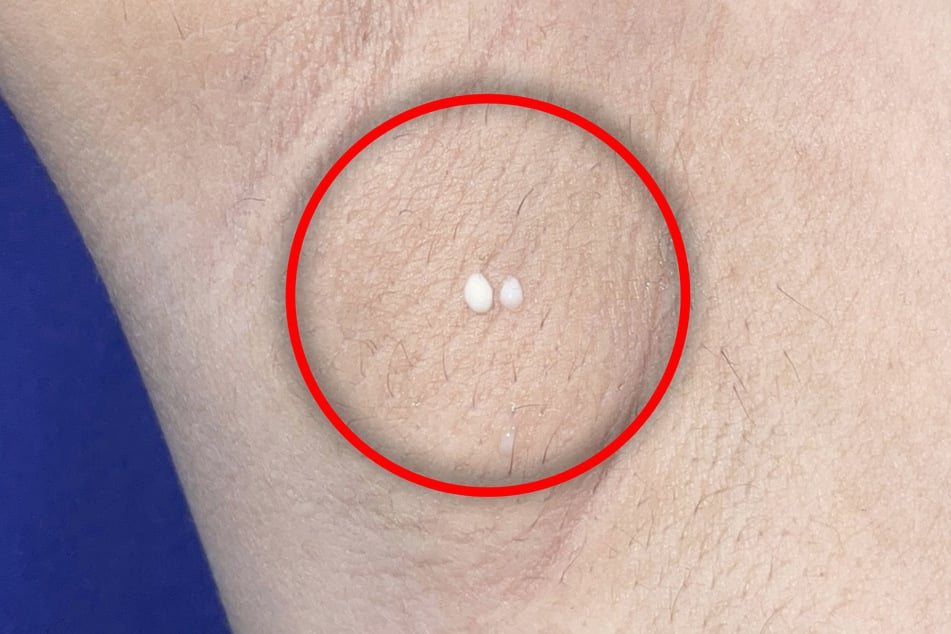 Nein, das ist kein Schweiß! Das ist Milch, die einer Frau von den Philippinen aus der Achselhöhle tropft.