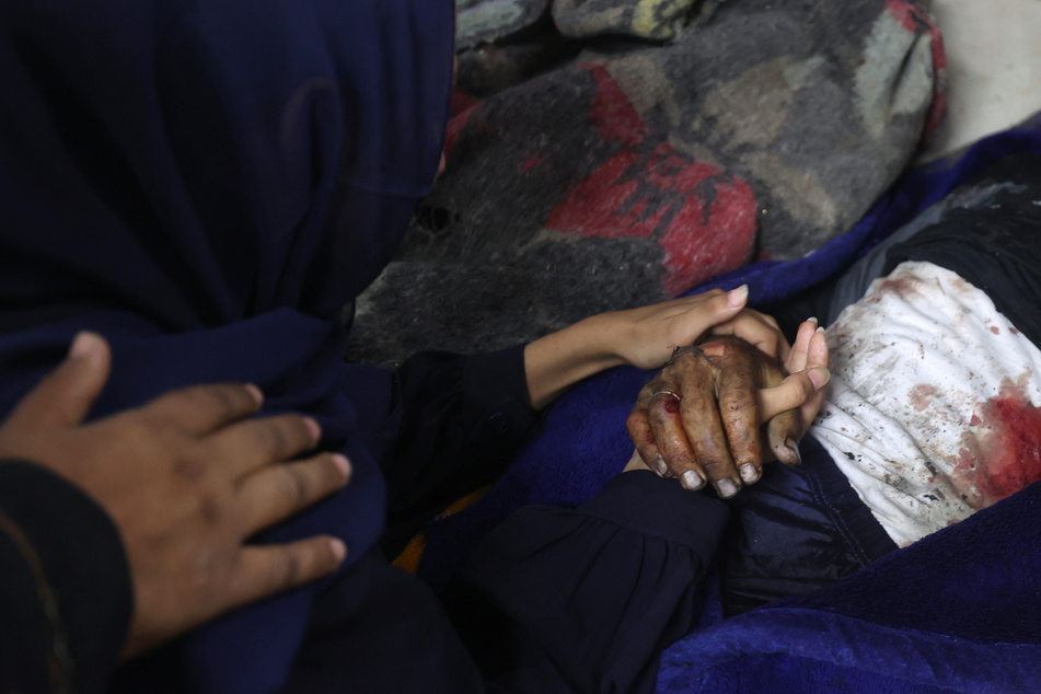 Foreign doctors in Gaza describe worst wounds "they've ever seen" in new report