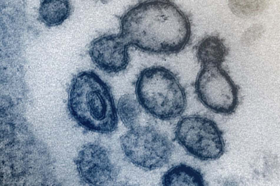 Die undatierte Aufnahme eines Elektronenmikroskops, die vom U.S. National Institutes of Health im Februar 2020 zur Verfügung gestellt wurde, zeigt das neuartige Coronavirus SARS-CoV-2.