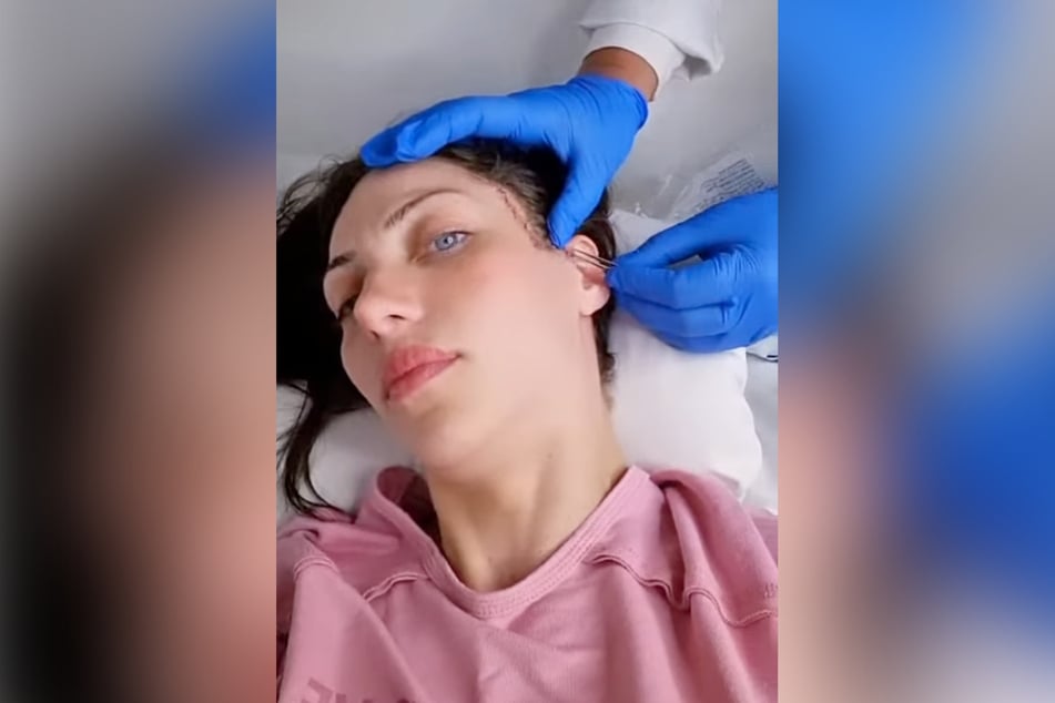 Die "Barbie-Influencerin" ließ sich mehrfach operieren - und das Internet daran teilhaben.