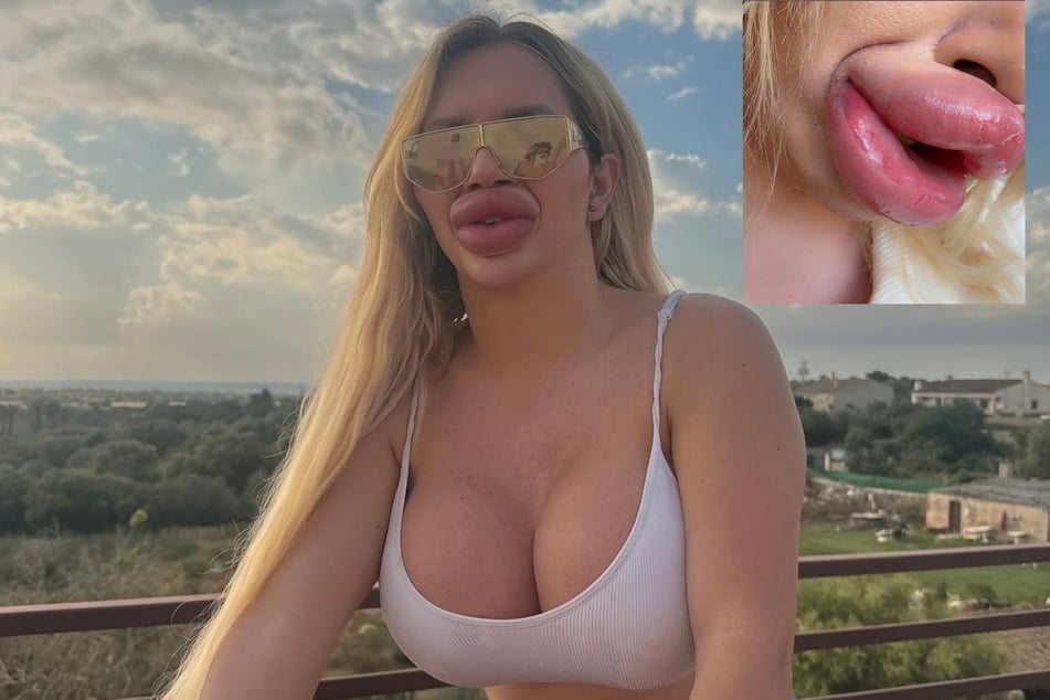 Die Blondine hat es schwer mit ihren aufgespritzten Lippen, da sie ihr den Weg zur Nase versperren.