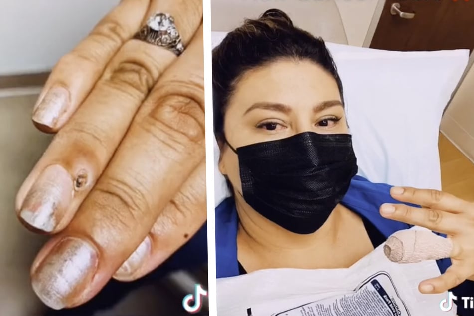 Schwer krank nach Maniküre! Frau in Salon an der Nagelhaut verletzt