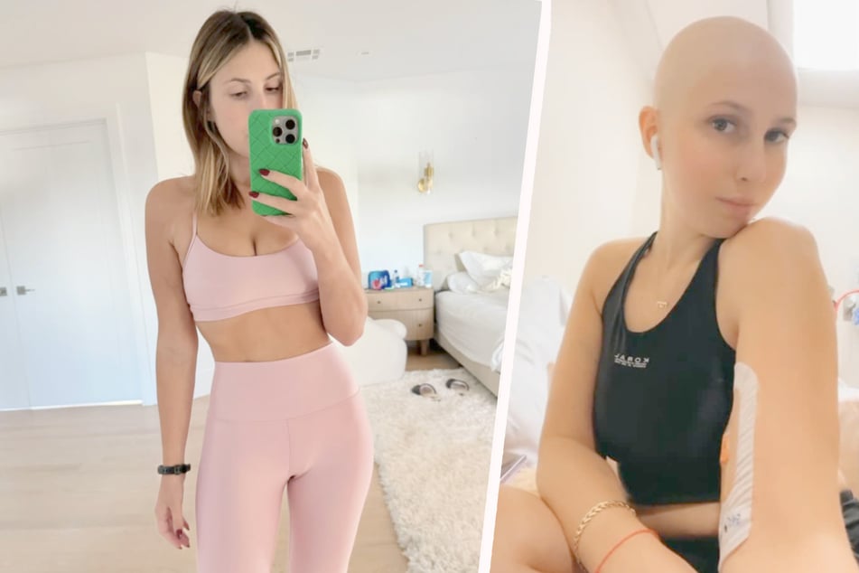 Durch die Chemotherapie verlor sie auch ihre Haare.