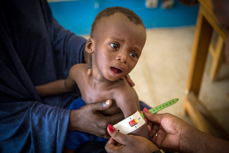 Im Gesundheitszentrum in Gao (Mali) wird der Armumfang eines 16 Monate alten und schwer unterernährten Jungen vermessen. (Archivbild)