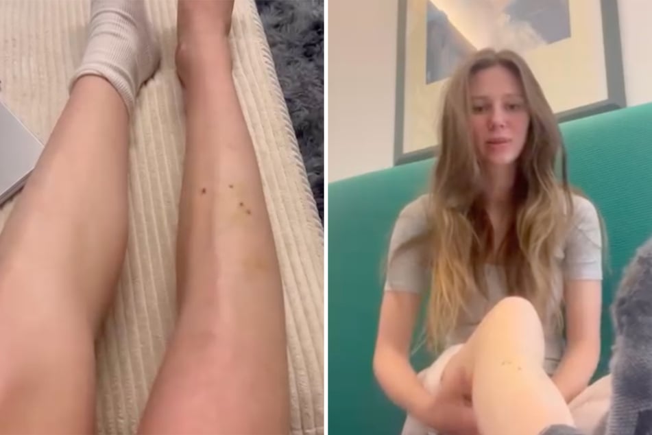 Ann-Kathrin Bendixen (24) aka "Affe auf Bike" hat sich nach ihrem Rollerunfall mit einem Update bei ihren Instagram-Fans gemeldet.