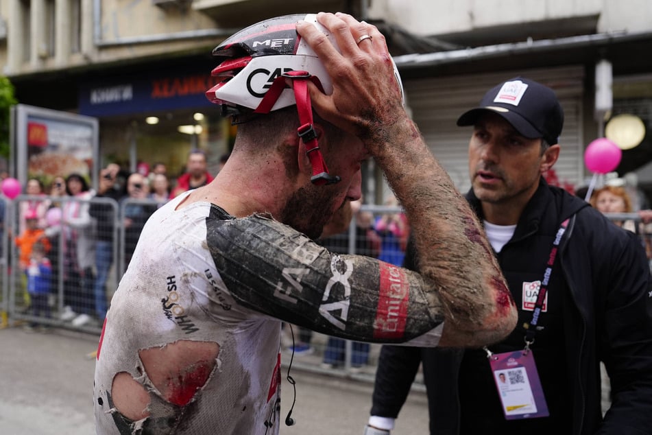 Für UAE-Kapitän Adam Yates (33) sind die Hoffnungen auf eine gute Platzierung im Gesamtklassement schon nach zwei Etappen dahin.