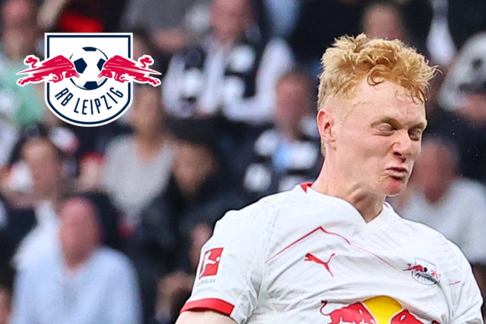 RB-Leipzig-Blog: Kurzfristiger Ausfall gegen Union Berlin!