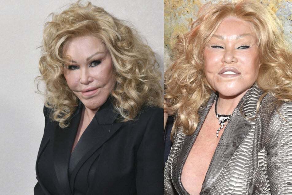 Swiss-born Jocelyn Wildenstein has undergone dozens of facial operations over the course of her life.