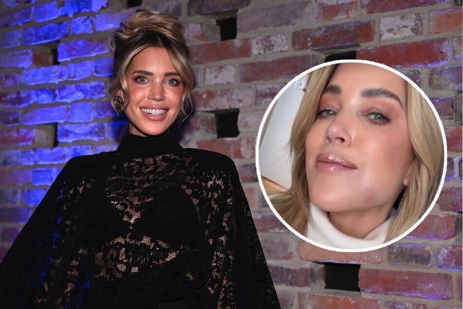 Sylvie Meis muss um Mitternacht zum Zahnarzt - der entdeckt Schreckliches