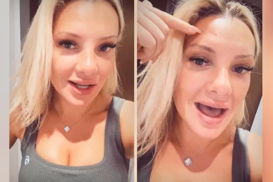 Evelyn Burdecki (31) erzählte ihren Instagram-Followern jüngst, dass sie sich beim Fotografieren an einem Stativ verletzt hat.