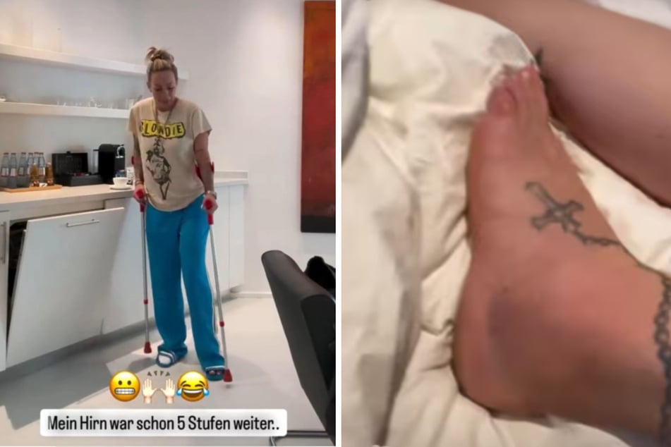 Die Ex-Frau von Ralf Schumacher (49) hat sich das Außenband an ihrem Fuß gerissen.