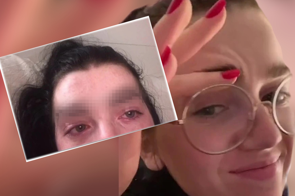 Frau will sich Augenbrauen verschönern lassen: Ergebnis ist ein "Desaster"