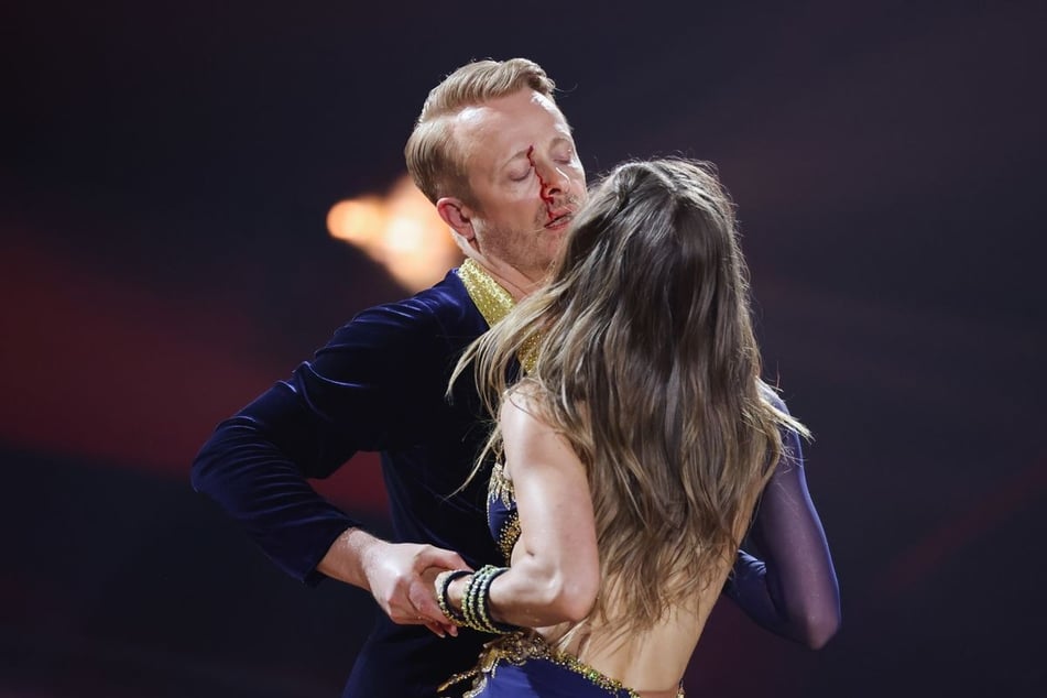 Trotz blutender Wunde am Auge brach Ross Antony (51) seinen Auftritt in der sechsten "Let's Dance"-Show nicht ab.