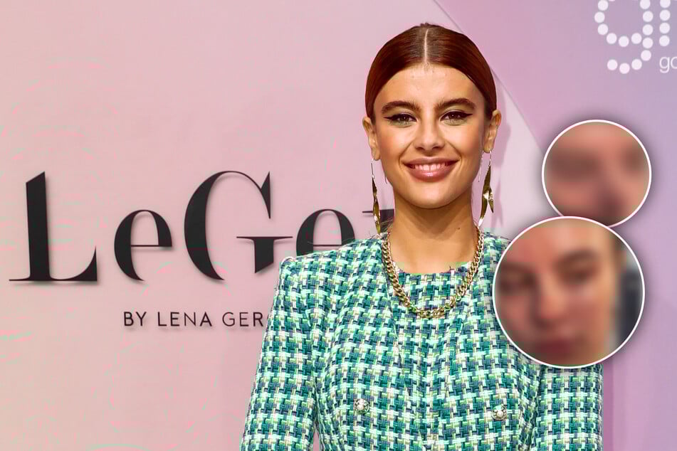 Ohne Filter und Schminke: GNTM-Model zeigt sich ungeschönt auf Social Media