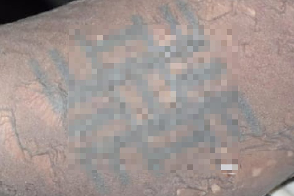 Der Tote hatte mehrere ungewöhnliche Tattoos, darunter dieses, das die Polizei als "eine Art Käfer" identifizierte.