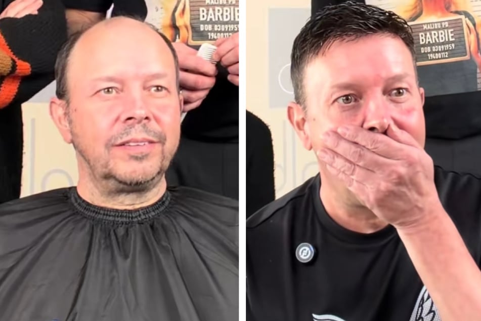 Steve (54) tuvo que pasar unos 24 años sin pelo en la cabeza. Cuando se ve por primera vez con el cabello completo, apenas puede creerlo.