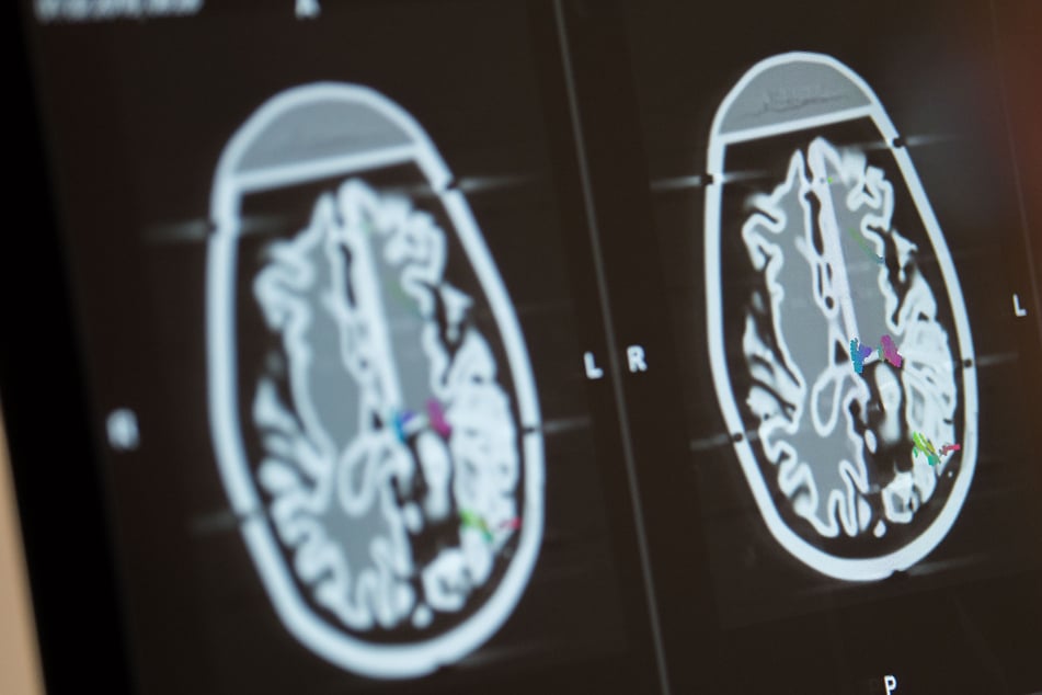 Mitteldeutsche Unis erhalten Millionenförderung für Forschung zu psychischen Erkrankungen