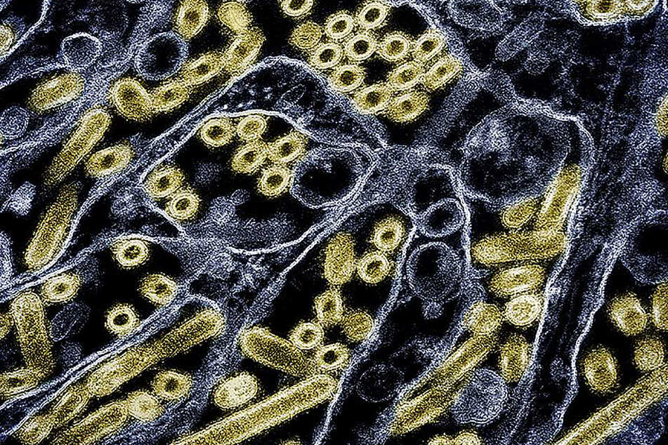 This handout picture courtesy of CDC and NIAID released on May 24, 2024 shows a colorized transmission electron micrograph of avian influenza A H5N1 virus particles (gold), grown in Madin-Darby Canine Kidney (MDCK) epithelial cells.