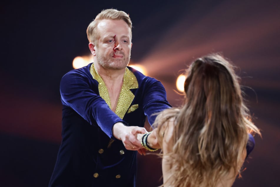 Schon bei der ersten Drehung von Mariia Maksina (28) hatte Ross Antony (51) eine blutende Platzwunde erlitten, musste danach minutenlang weitertanzen.