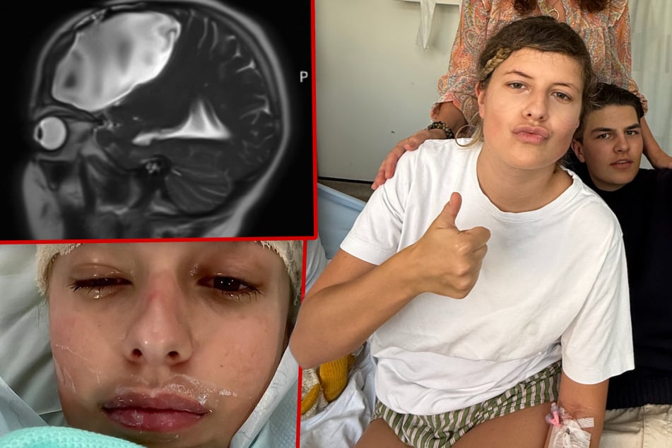 Hirntumor wird nur wegen Alkohol-Exzess entdeckt: Kann todkranke Studentin noch gerettet werden?