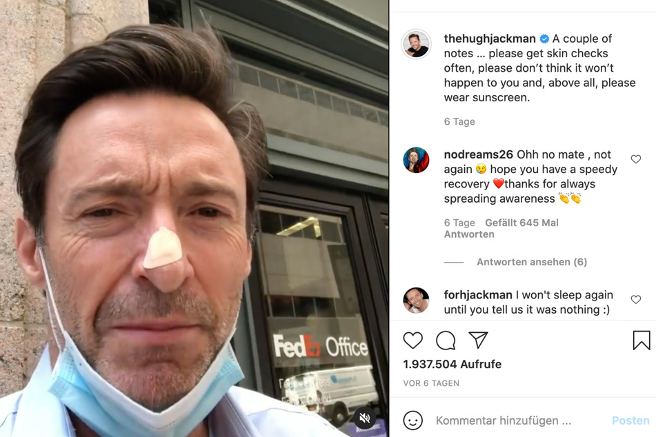 The band-aid on Hugh Jackman's (52) nose is not a good sign.