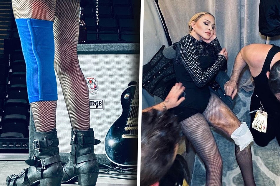 Madonna reveals shock injury at Celebration World Tour rehearsals