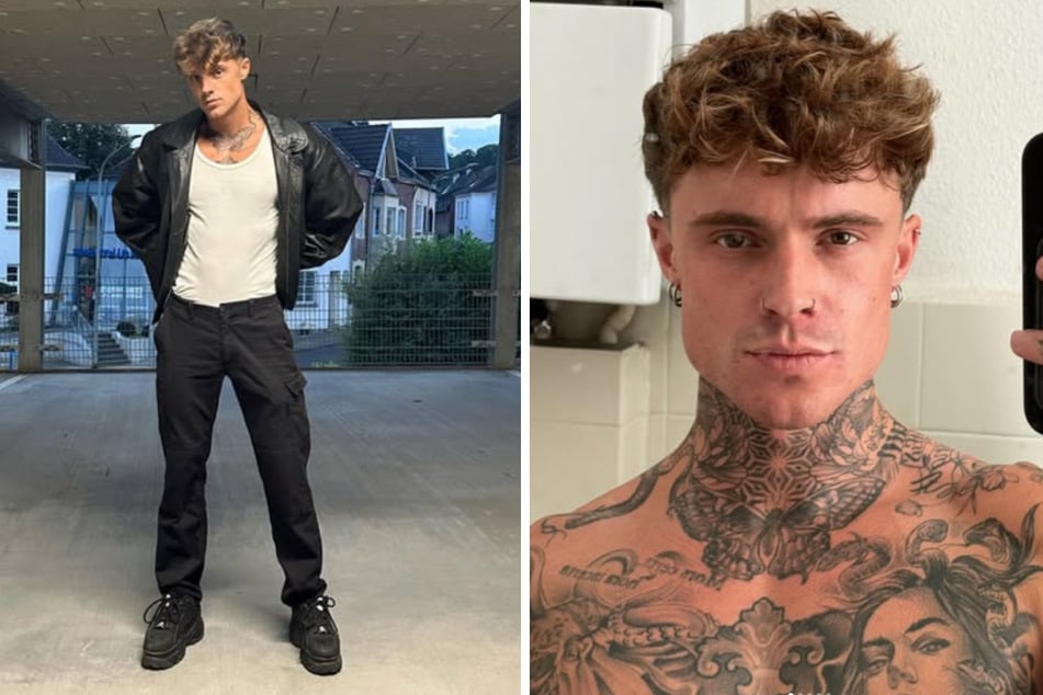 Ex-"GNTM"-Kandidat Samuel Dohmen (23) befindet sich nach einer Not-OP wieder auf dem Weg der Besserung.