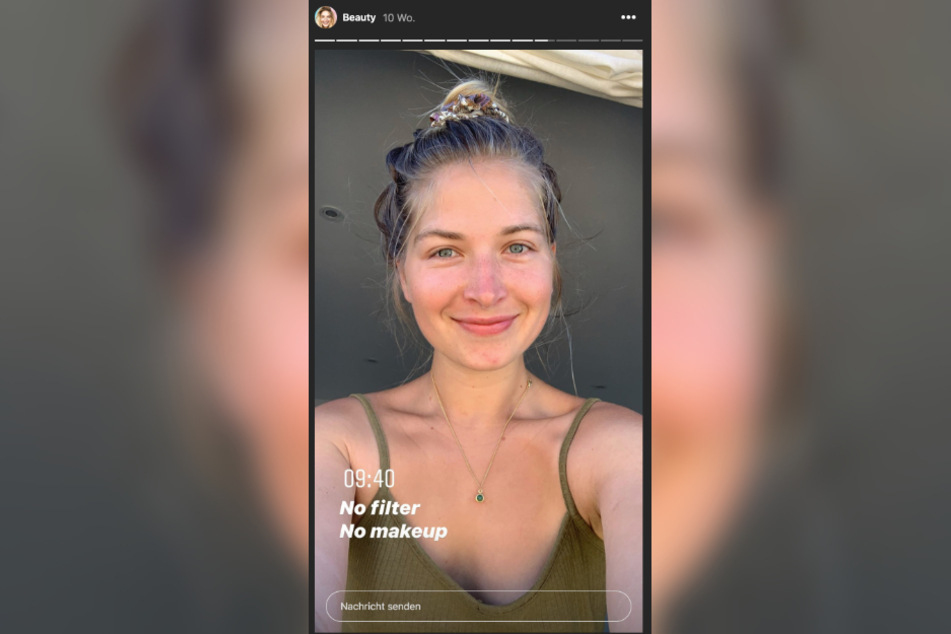 In ihren Beiträgen und Storys auf Instagram sprüht Charlotte Weise (28) meist vor positiver Energie.