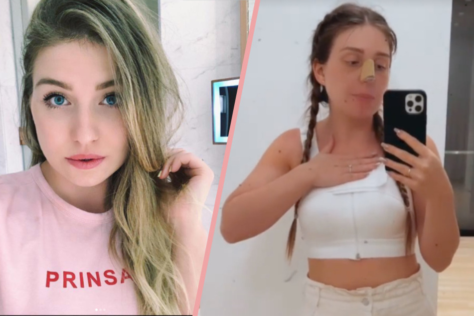 Nachdem ihre Instagram-Follower bereits den geschienten Riechkolben bewundern durften, präsentierte Bianca Claßen (28) nun auch erstmals ihre neue Oberweite.