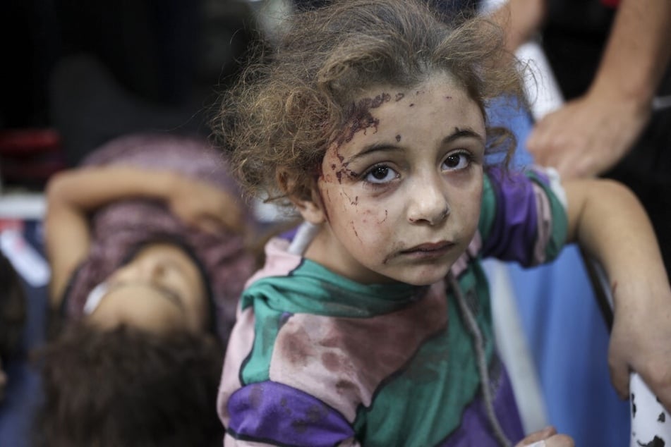 Children who were injured during an Israeli attack on the Jabalia refugee camp in the northern Gaza Strip await treatment at Al-Ahli Arab hospital in Gaza City.