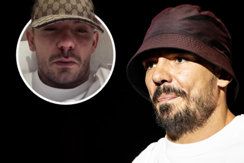 Capital Bra: Capital Bra wieder in die Sucht abgerutscht: "Ich kann nicht mehr"