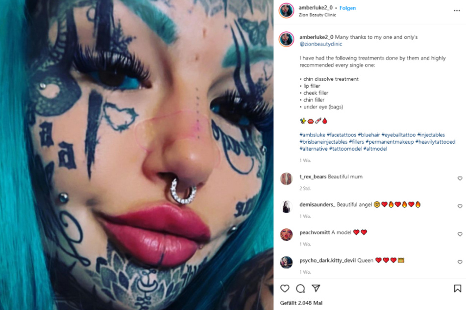 Auf Instagram berichtete Amber Luke (26) von ihren neuesten Schönheits-Operationen.