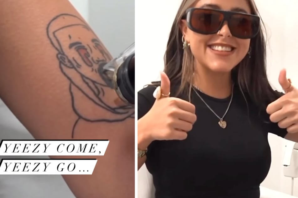 Company offers to get rid of your Kanye West tattoo for free