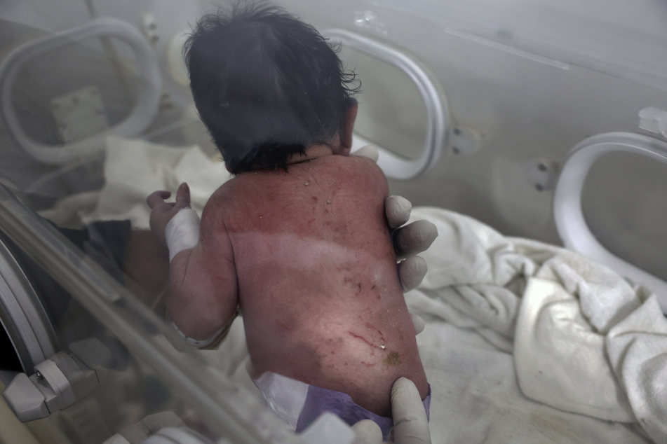 Das kleine Mädchen wird in einem Inkubator in einem Kinderkrankenhaus behandelt.