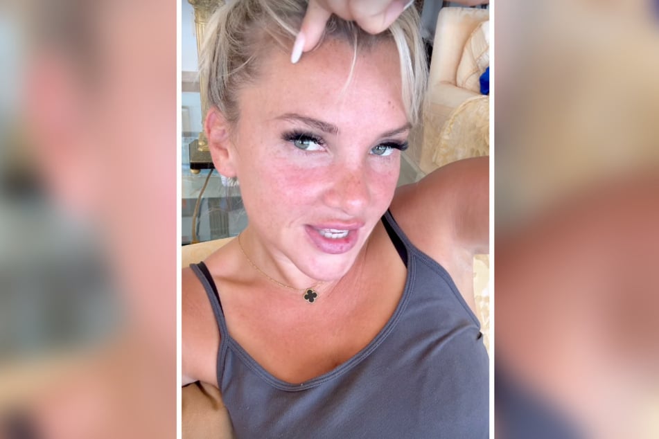 Auf Instagram sprach Evelyn Burdecki ganz ungeniert und schamlos über ihr Schönheitsproblemchen.