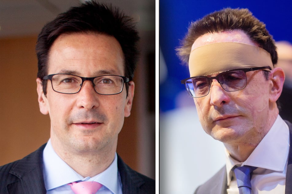 Dr. Bernhard Günther vor dem Säurenanschlag 2018 (l.) und danach (2020).