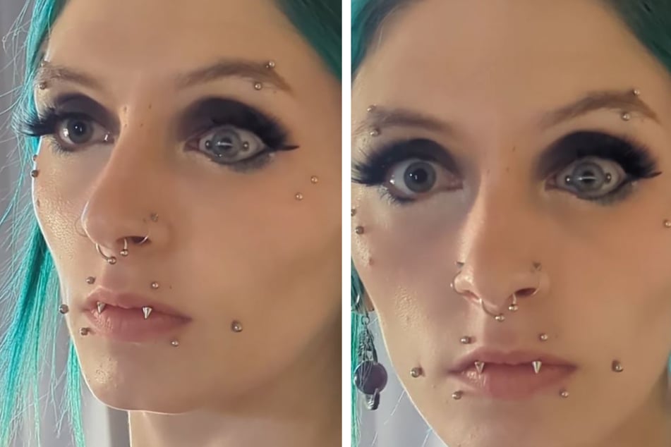 "Cyclops" Instagramer shows off shocking eye piercing: "Stay Weird"