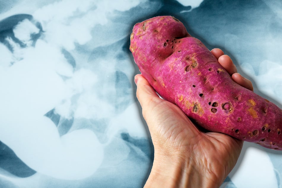 Mann steckt sich riesige Süßkartoffel in den After: Seine Gründe machen fassungslos