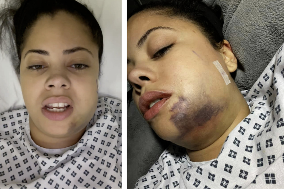 Rosina (30) erzählte auf Facebook von dem schrecklichen Vorfall.